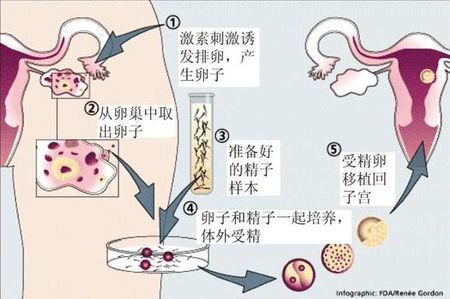 Dr. Li